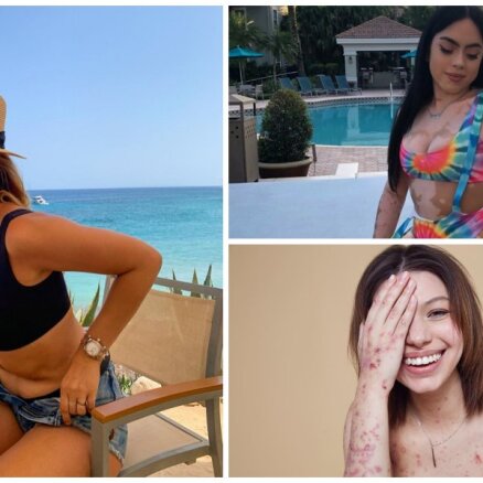 Salauzt perfekto 'Instagram' lenti: iedvesmojošas sievietes, kas drosmīgi izrāda savu ķermeni