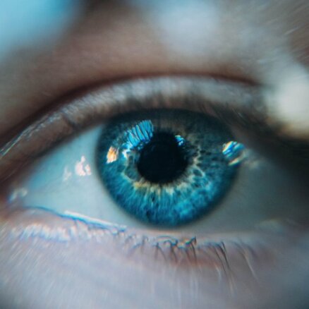 Gala stadija – pilnīgs un neatgriezenisks redzes zudums. Kas jāzina par glaukomu