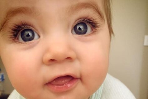 Pasauli sajūsmina astoņus mēnešus veca zīdaiņa acis