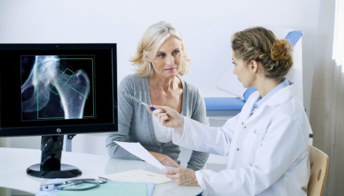 Osteoporozes dēļ kauli var lūzt pat nošķaudoties. Ārsta ieteikumi profilaksei