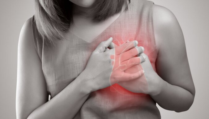 Miokarda infarkts – vēl aizvien daudziem nezināms