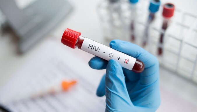 Gunta Stūre: HIV mūsdienās vairs nav nekas ārkārtējs