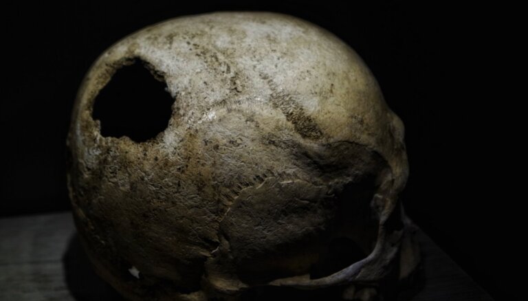 Strīdas par caurumu pirms 3400 gadiem apbedīta vīrieša galvaskausā